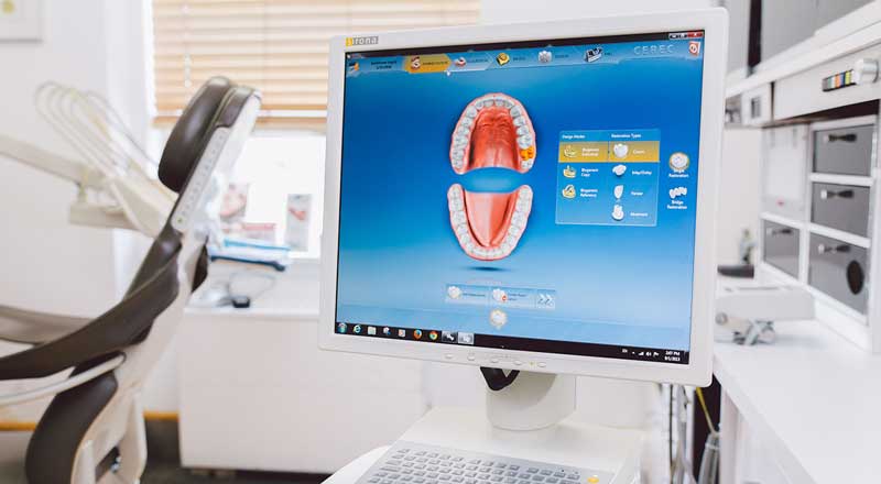 CEREC Nichelino