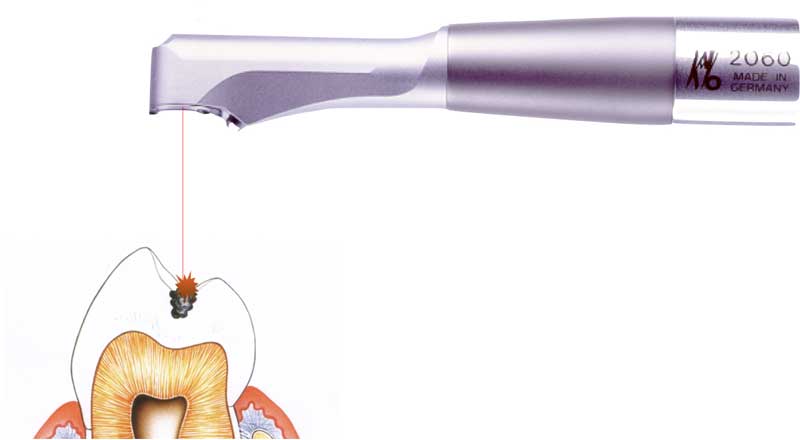 Odontoiatria Laser Roma